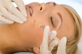 Best Dermal Fillers